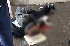 В Петербурге взрывом подростку оторвало руку