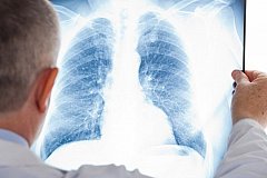 Ученые России придумали сверхчувствительный быстрый тест на туберкулез.