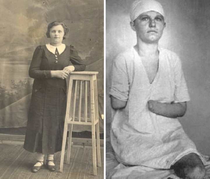 Зина до войны и после тяжелого ранения в госпитале.