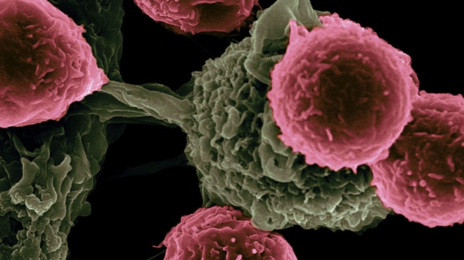 Ученые-онкологи заговорили о способе победить неизлечимый рак